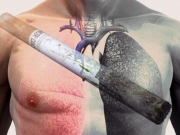 Курение и рак