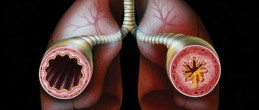 Бронхиальная астма — описание