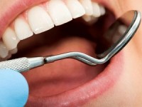 Особенности ультразвуковой очистки зубов